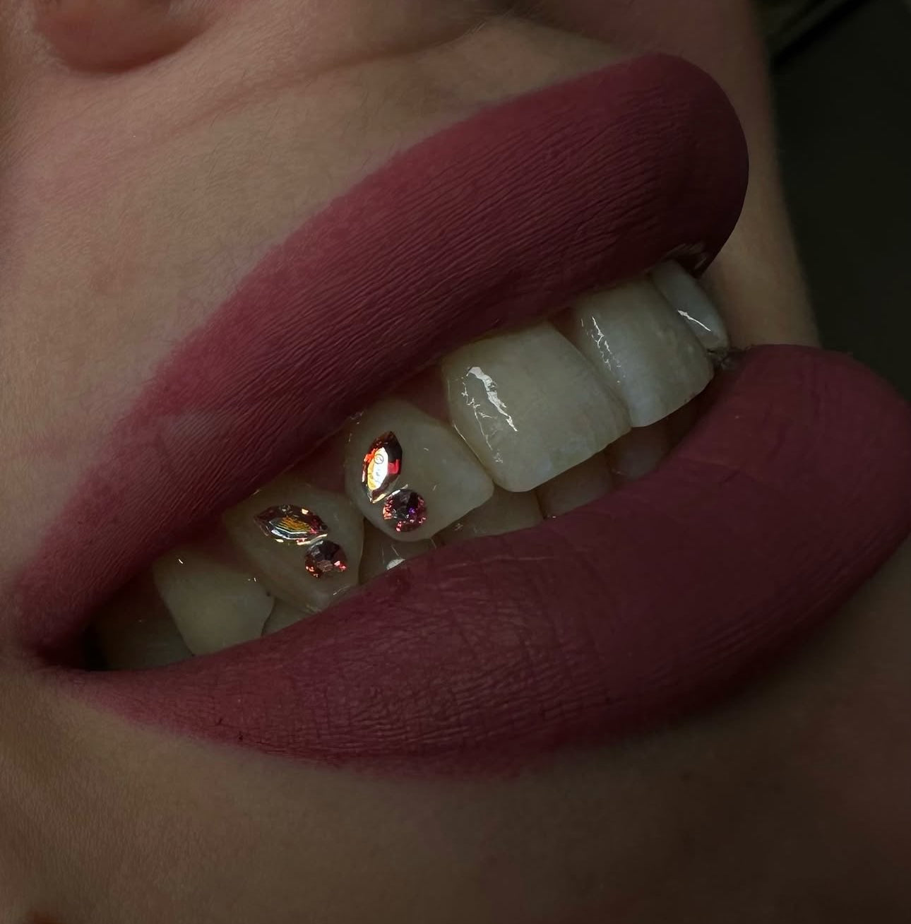 Swarovski Crystal Oval Tooth Gem