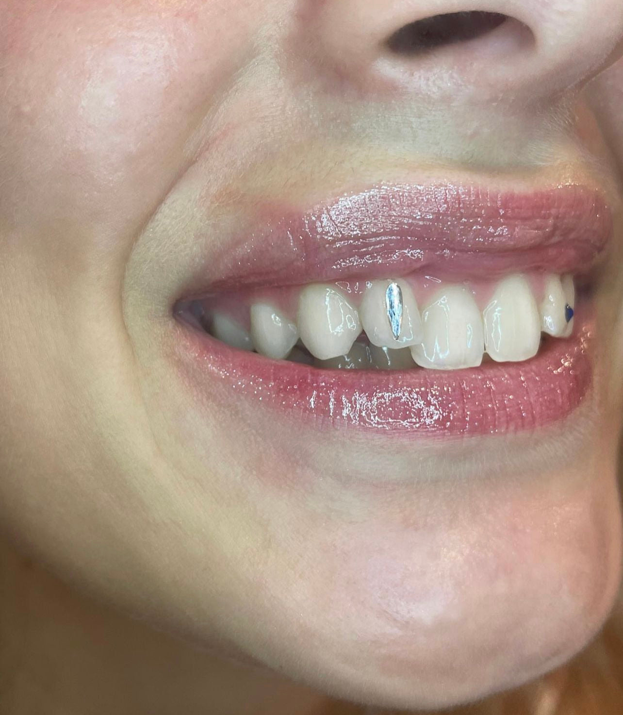 Swarovski Crystal Raindrop Tooth Gem