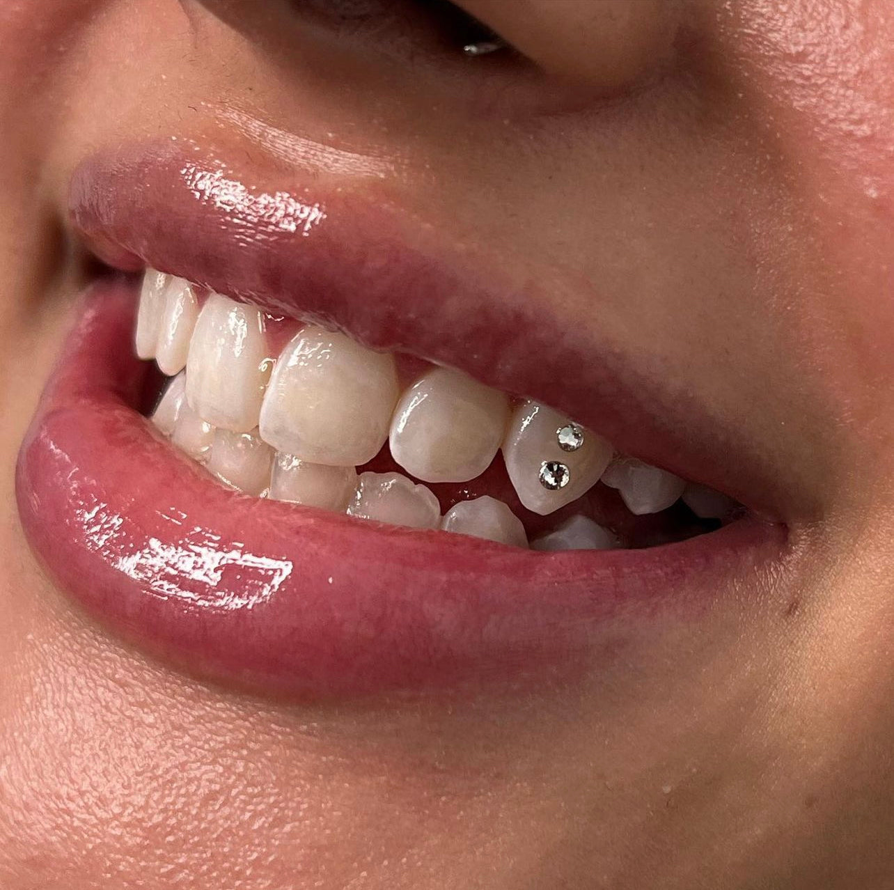 What to Know about Crystal or Diamond Teeth Gems
