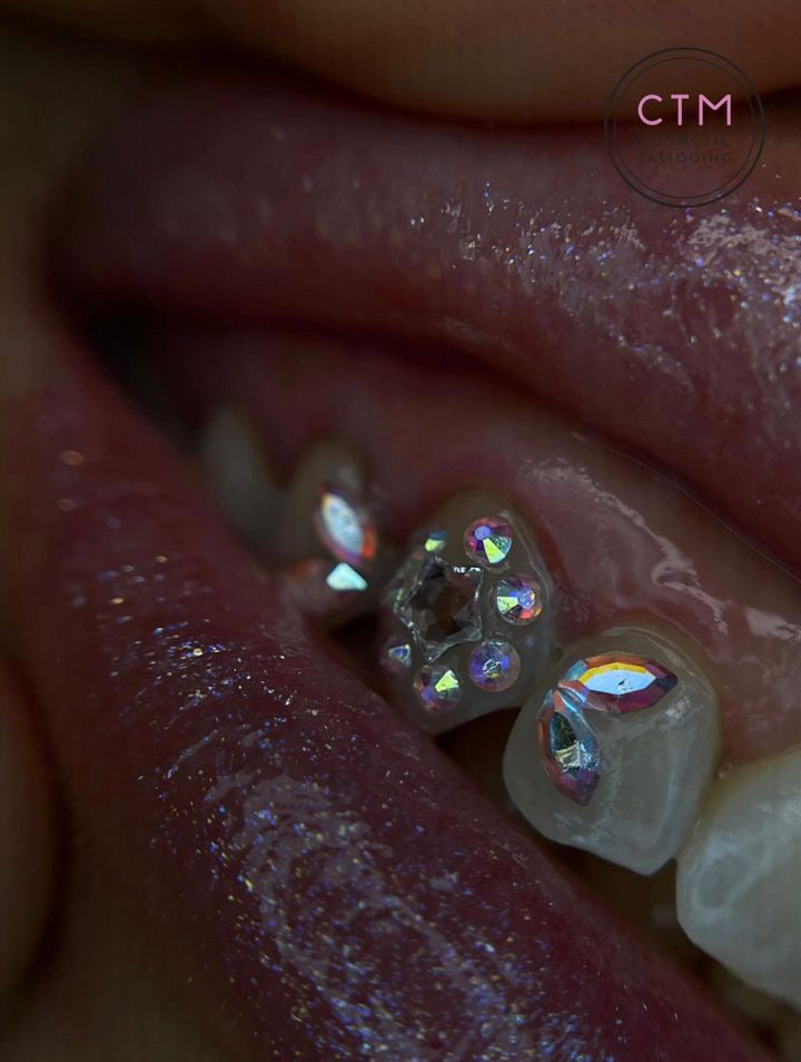 Crystal tooth gems