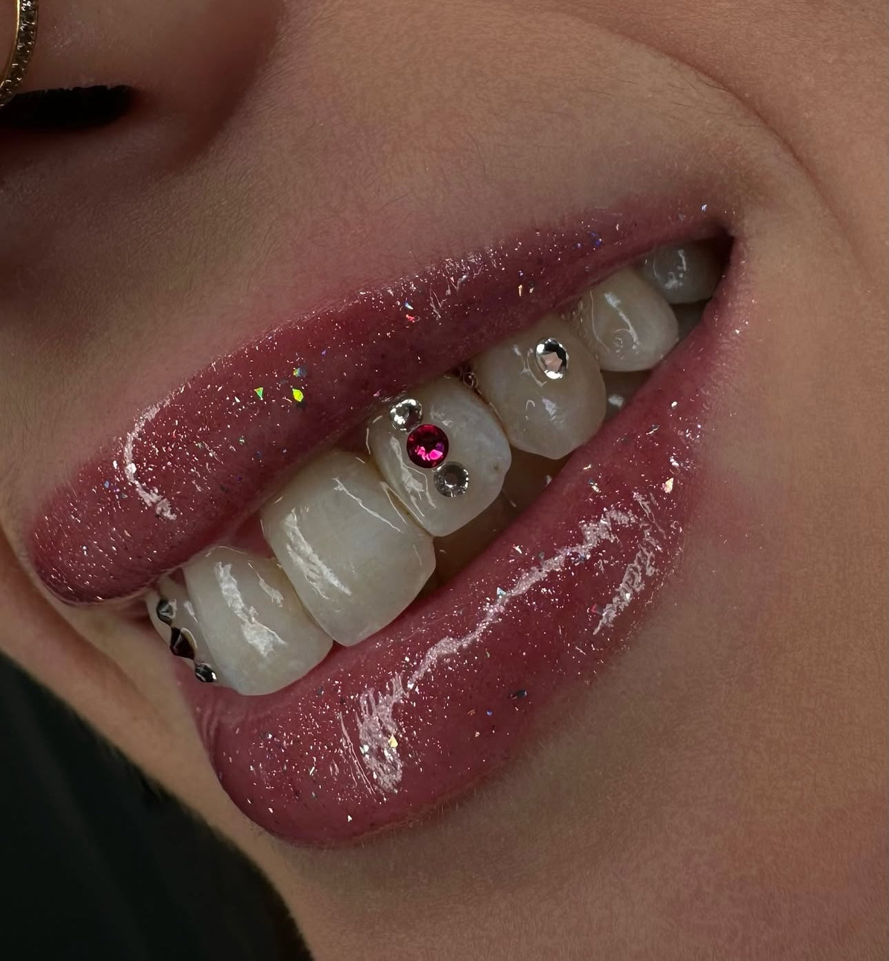 Tooth Gems Crystals